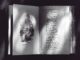 A black and white photo of an open book displaying text and an illustration.